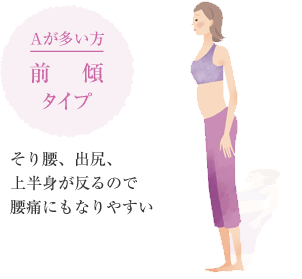 Aが多い方　前傾タイプ　そり腰、出尻、上半身が反るので腰痛にもなりやすい